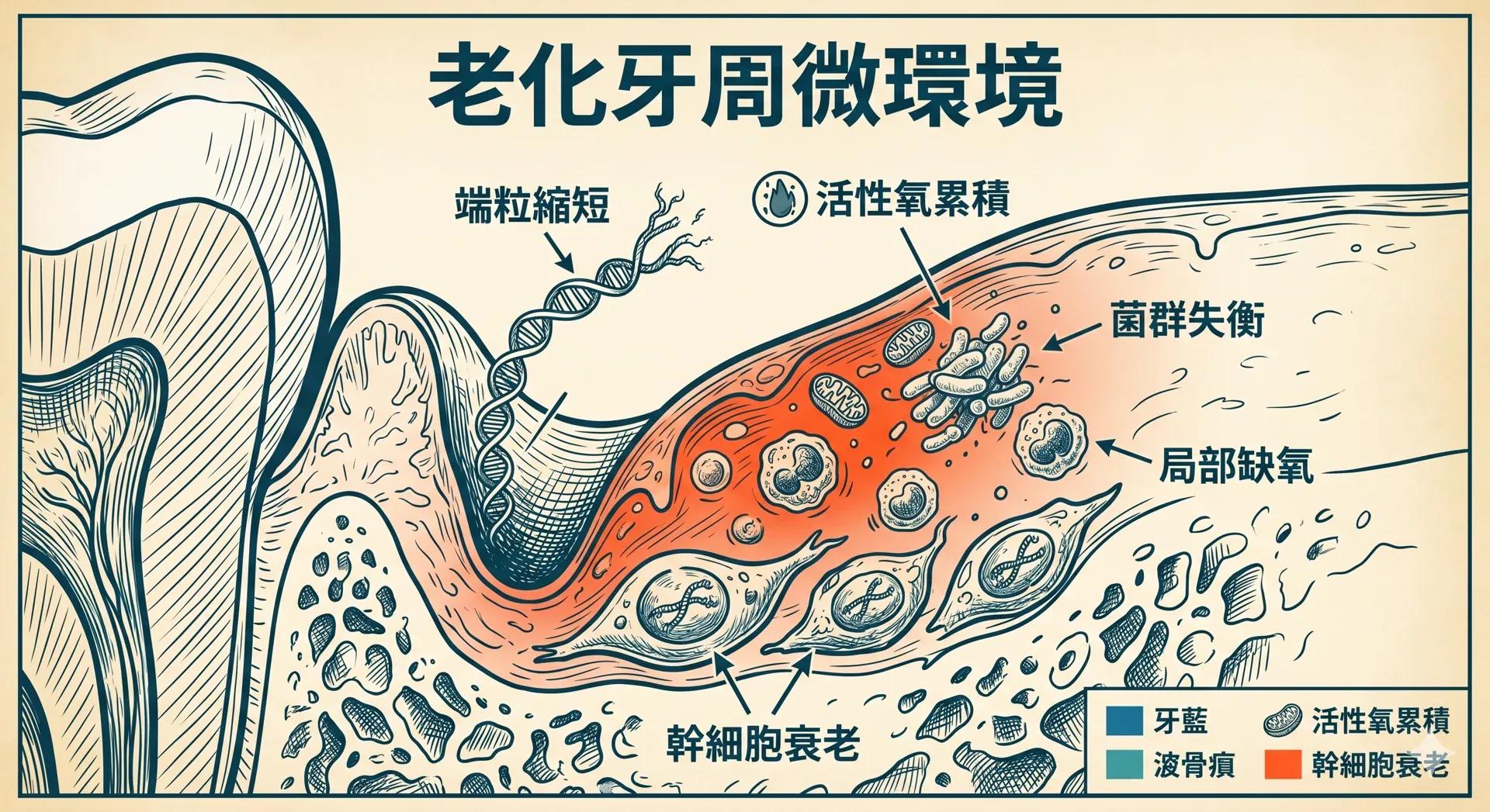 多酚鋅氧協同水凝膠重塑牙周衰老微環境：端粒損傷幹細胞的再生新策略